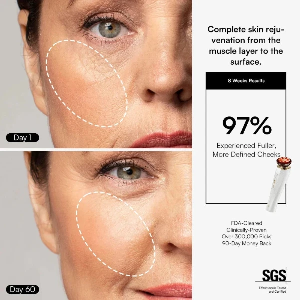 NovaDerm 3-in-1 Facial Sculptor