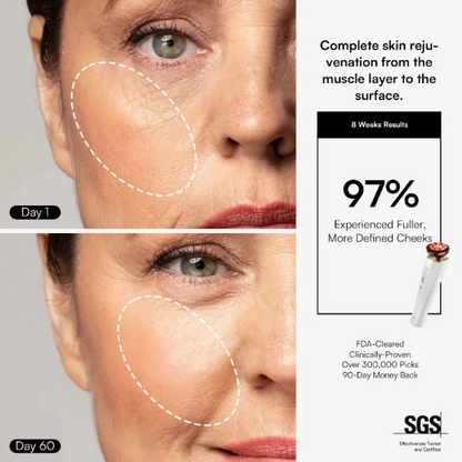 NovaDerm 3-in-1 Facial Sculptor