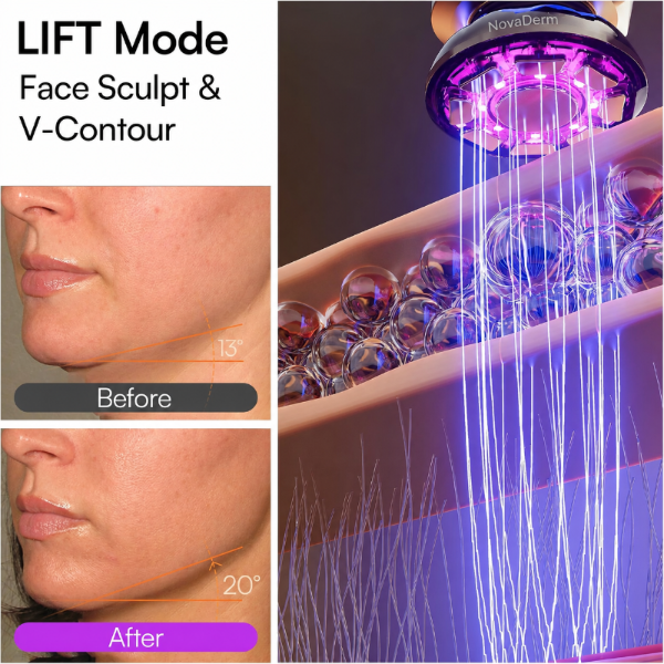 NovaDerm 3-in-1 Facial Sculptor