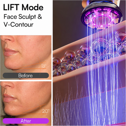 NovaDerm 3-in-1 Facial Sculptor